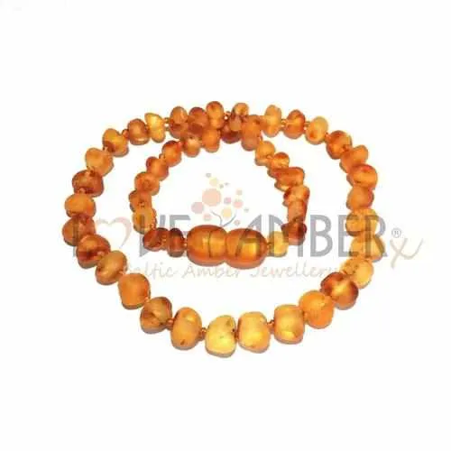 Adult Bees Knees Raw Honey Baltic Amber Necklace