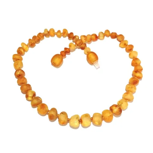 Adult Bees Knees Raw Honey Baltic Amber Necklace